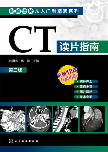 CT读片指南