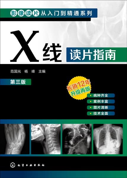 X线读片指南