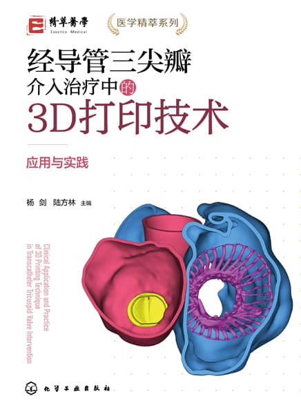 经导管三尖瓣介入治疗中的3D打印技术——应用与实践