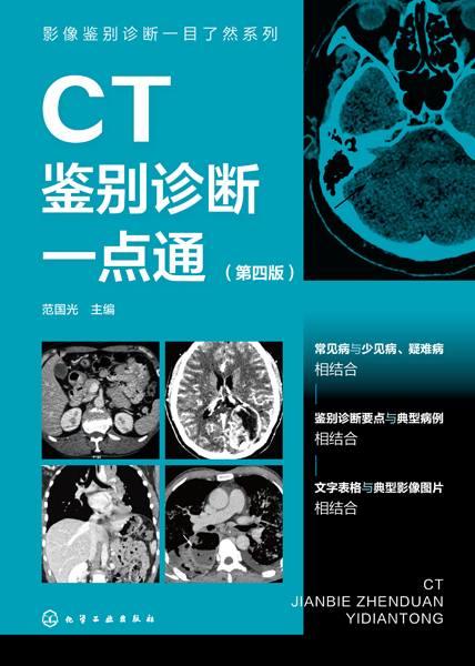 CT鉴别诊断一点通