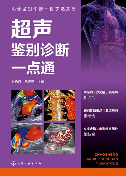 超声鉴别诊断一点通