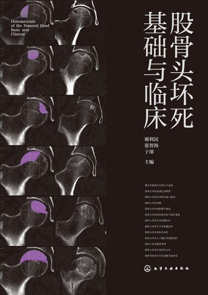 股骨头坏死基础与临床