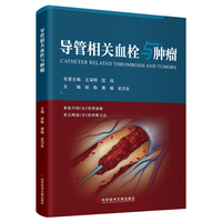 导管相关血栓与肿瘤