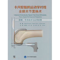 卡尺校验的运动学对线全膝关节置换术：原理、手术技术与应用前景