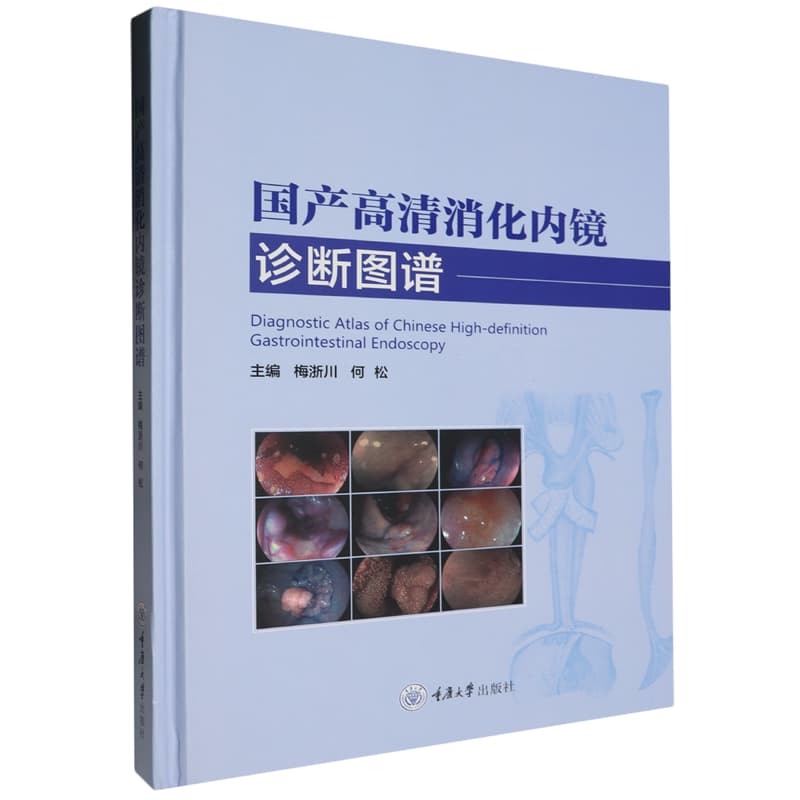 国产高清消化内镜诊断图谱